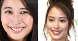 【画像比較】広瀬アリスの顔が変わった?顎を整形か!?噂の真相を徹底追求!! | お顔の研究所