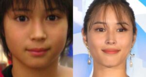 【画像比較】広瀬アリスの顔が変わった？顎を整形か！？噂の真相を徹底追求！！ | お顔の研究所