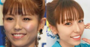 【画像比較】若槻千夏の顔が変わった!?鼻の違和感は整形したから?より可愛くなった理由を徹底調査! | お顔の研究所