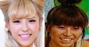 【画像比較】若槻千夏の顔が変わった!?鼻の違和感は整形したから?より可愛くなった理由を徹底調査! | お顔の研究所