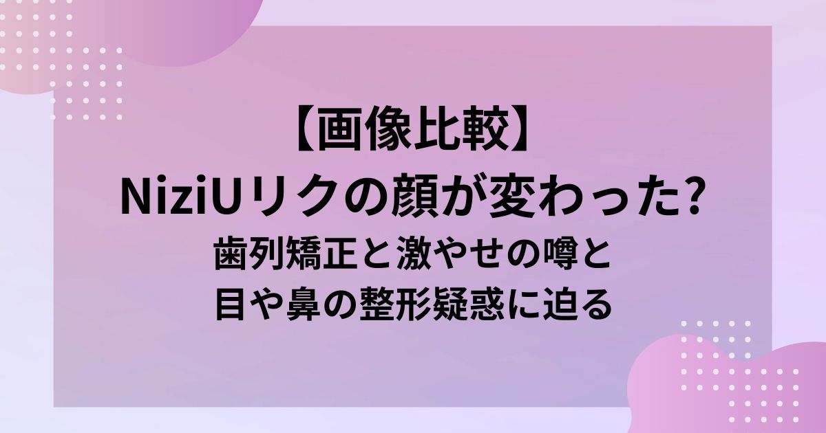 【画像比較】 NiziUリクの顔が変わった?